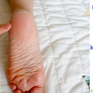 Profilaktyka odleżyn w praktyce – skuteczna opieka każdego dnia