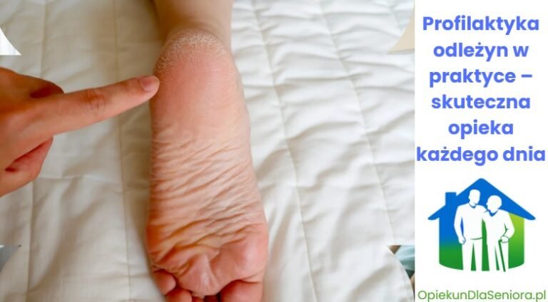 Read more about the article Profilaktyka odleżyn w praktyce – skuteczna opieka każdego dnia z TENA